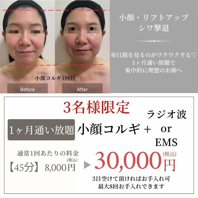 お得な通い放題キャンペーン
あと1名様ご案内できます✨
集中的に小顔にしたい、リフトアップしたいって方は是非♡
